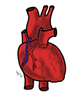 Le pontage aortocoronarien relie l’aorte à une artère coronaire.